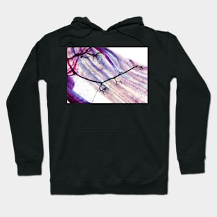 Muscle motor neurones, light micrograph (C007/8436) Hoodie